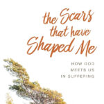 Scars that have shaped me